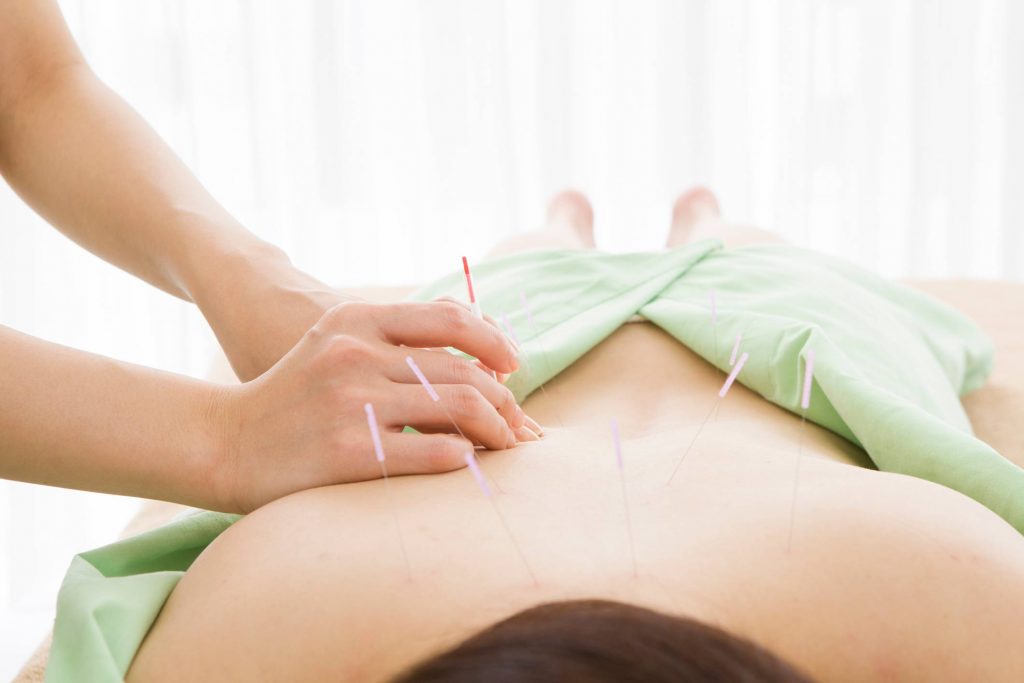acupuncture services sydney